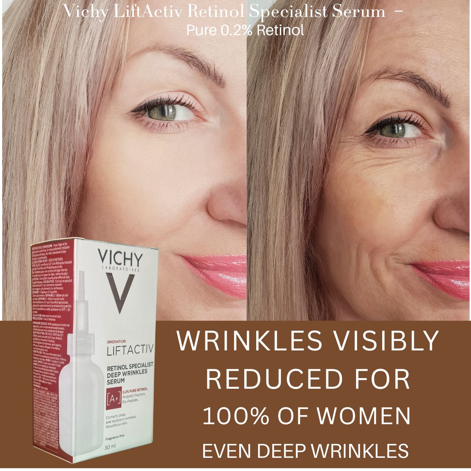 Vichy LiftActiv Retinol Specialist Serum packaging with before and after effects on a woman's face.